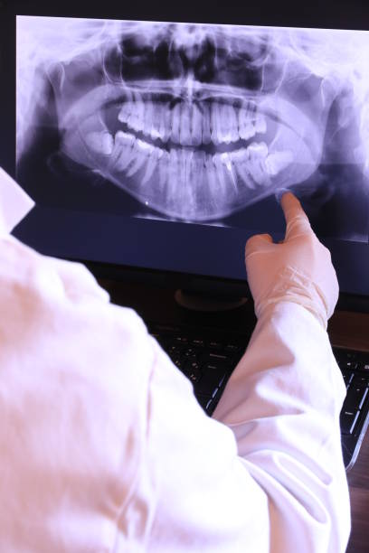 Best Emergency Dental Care for Broken or Chipped Teeth in Mcswain, CA
